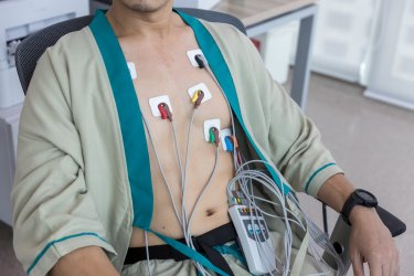 Rozmieszczenie elektrod przy badaniu holterem EKG