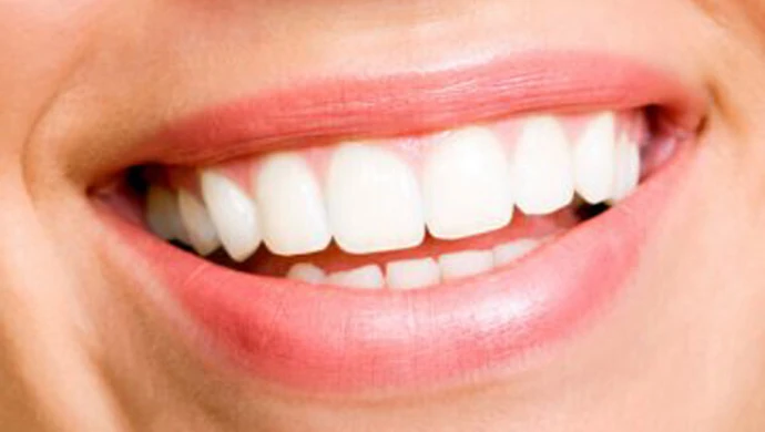 LICÓWKI, czyli sposób na białe zęby 