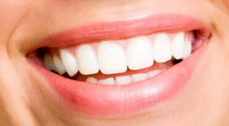 LICÓWKI, czyli sposób na białe zęby 