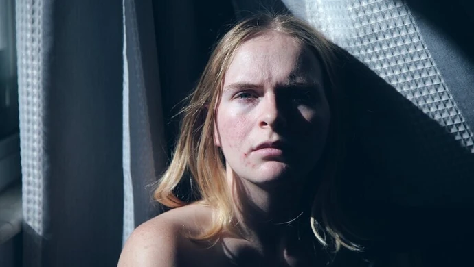 Cera trądzikowa - jak ją zwalczyć?