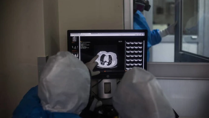 Badania: COVID-19 atakuje nie tylko płuca, wpływa również na mózg, nerki czy serce