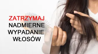 Nadmierne wypadanie włosów &#8211; sprawdź, co warto wiedzieć