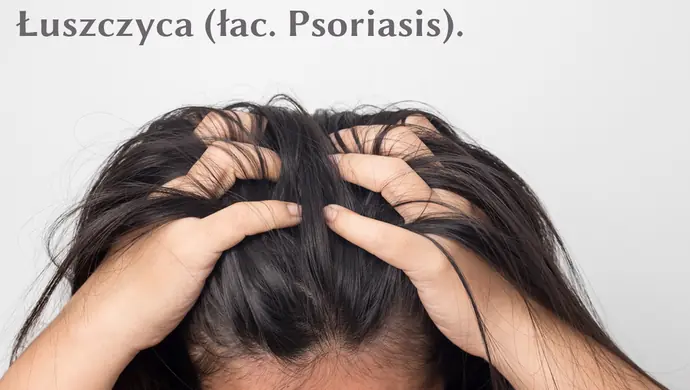 Szampon na łuszczycę - jak działa?
