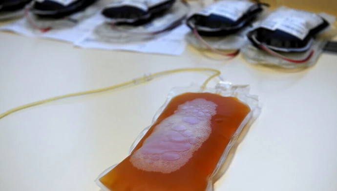 Prof. Radziwon: znów potrzeba osocza od ozdrowieńców, nie ma zapasów