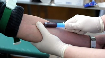 Nie każdy &#8222;dobry&#8221; cholesterol jest korzystny dla zdrowia