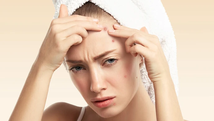 Czy tabletki na trądzik są skuteczne?