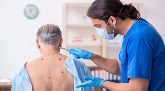 Bezbolesne usuwanie znamion &#8211; czy jest możliwe? I jak przebiega?