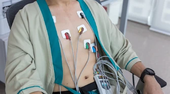 Rozmieszczenie elektrod przy badaniu holterem EKG