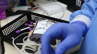 Osocze bogatopłytkowe &#8211; naturalny sposób na odmłodzenie skóry