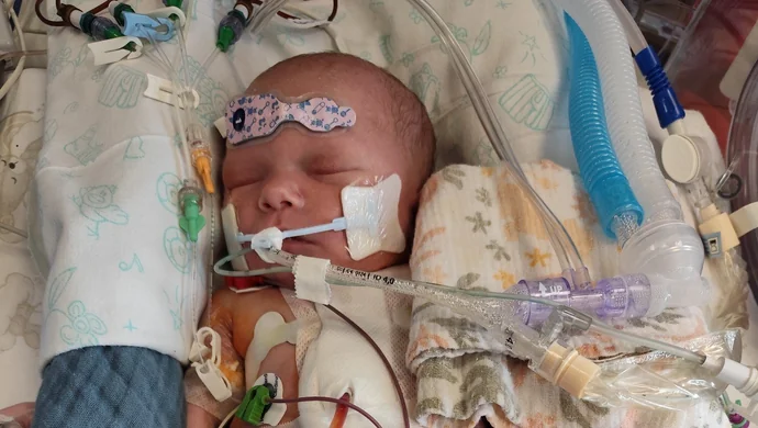 Kilkumiesięczny Leoś walczy o życie. Trwa zbiórka na jego leczenie